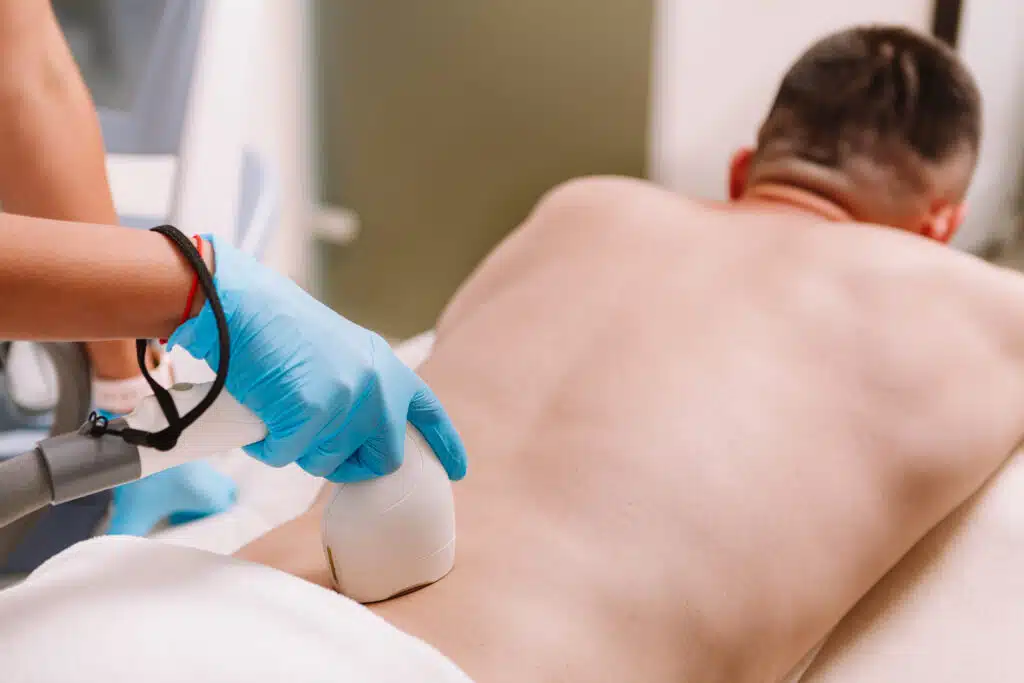 professional removing back hair from male client with professional equipment